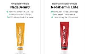 Nadaderm Review